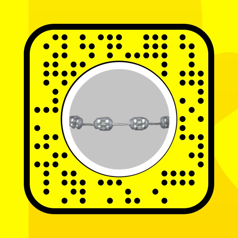 Braces Silver Lens by Roselyn Snapchat Lenses and Filters