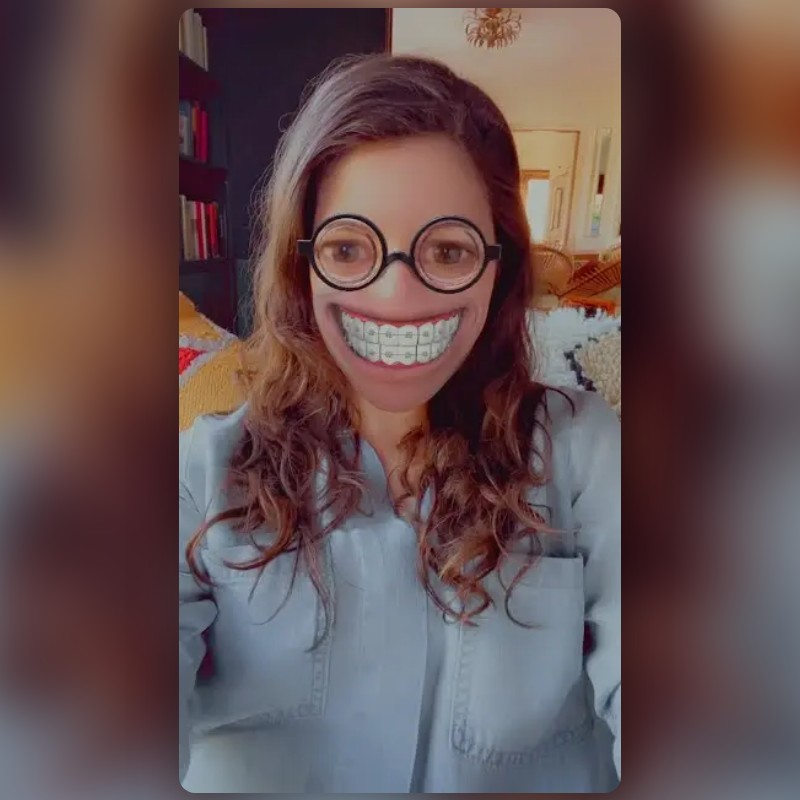 Braces Smile Lens by Snapchat Snapchat Lenses and Filters