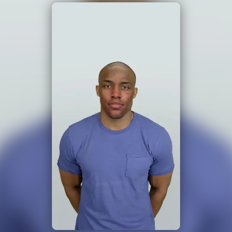 Acne Filter Effect Cystic Acne Filter by Medical Lenses | Snapchat Lenses
